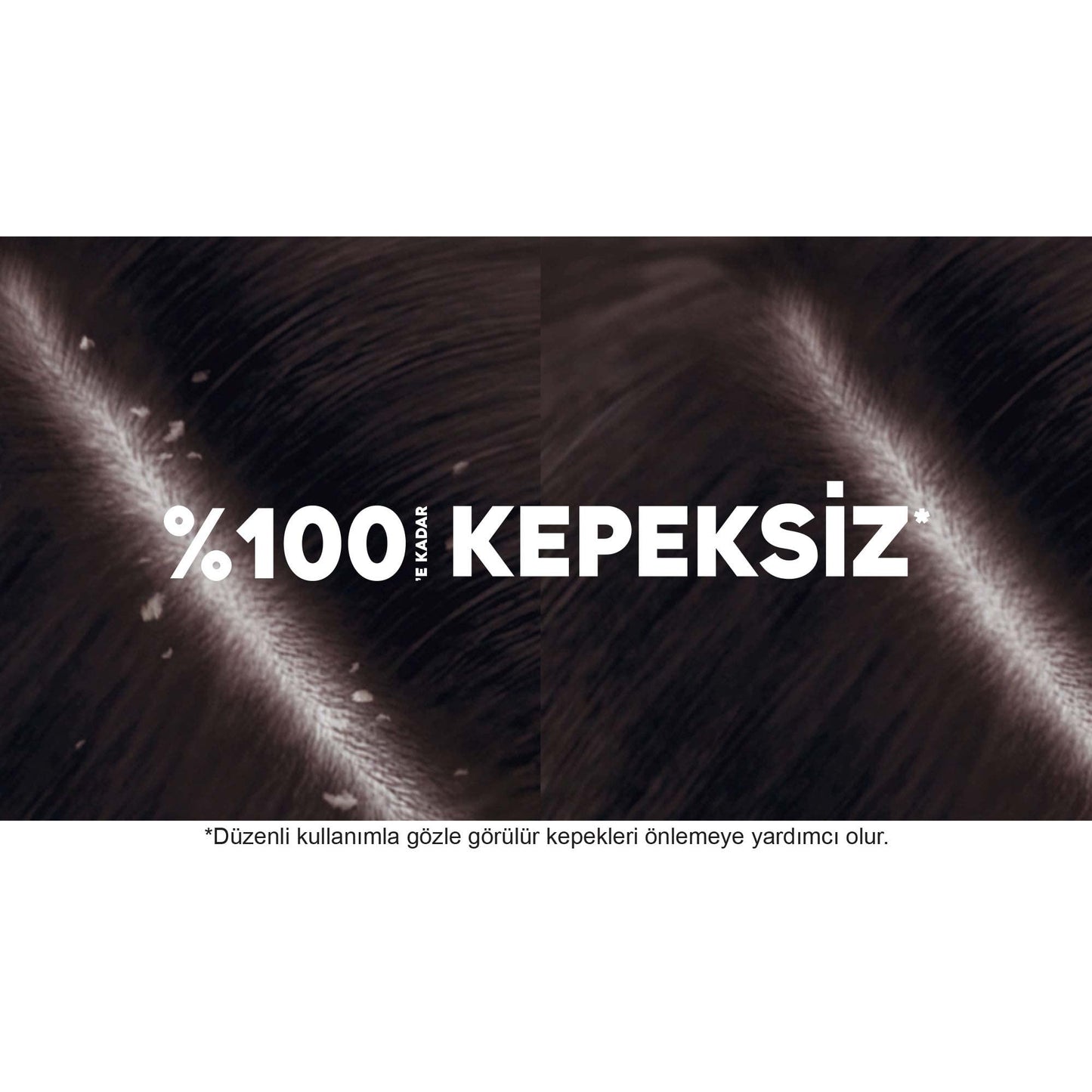 Head & Shoulders Şampuan Kepeğe Karşı Etkili, 350 ml