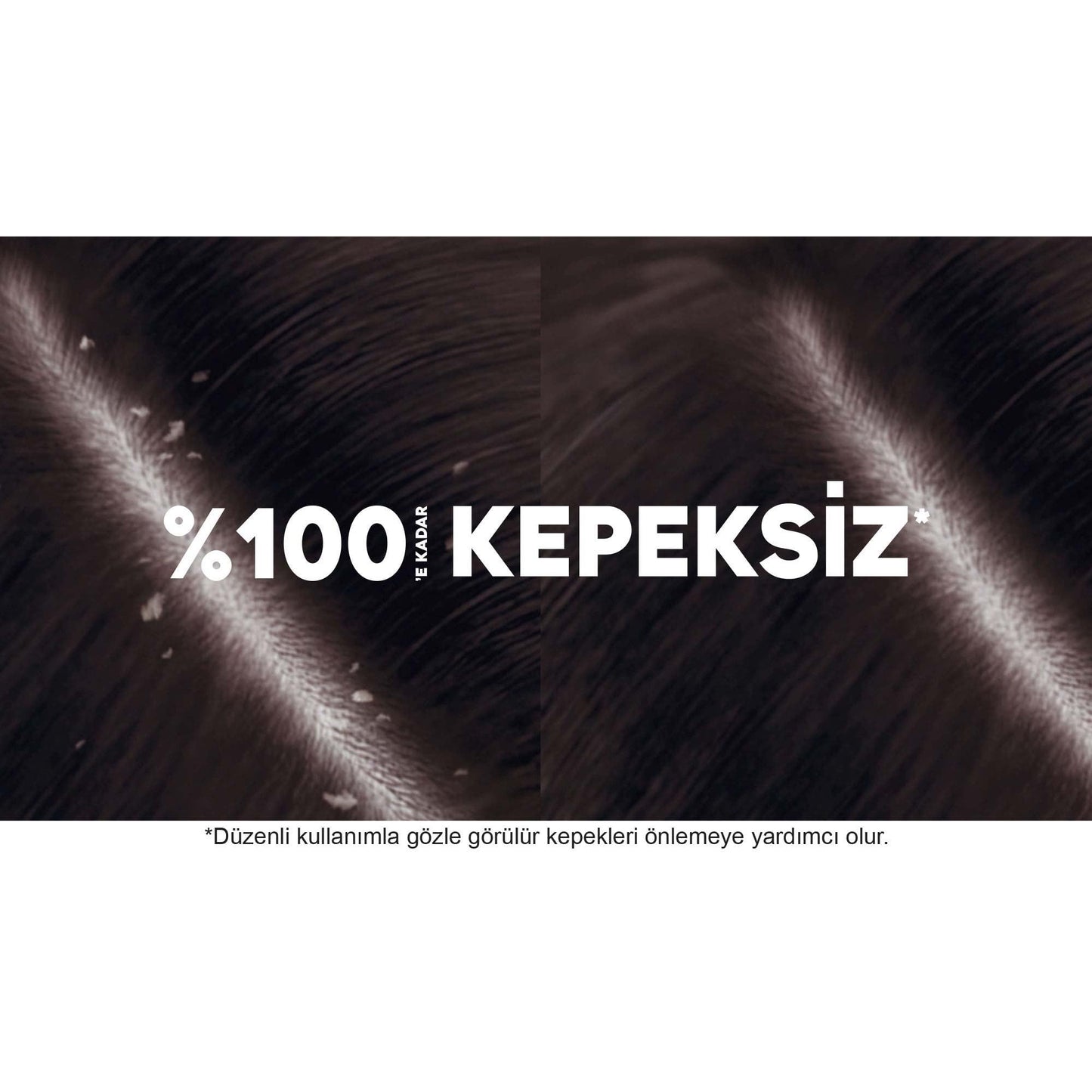 Head & Shoulders 2'si 1 Arada Şampuan Kepeğe Karşı Etkili, 350 ml